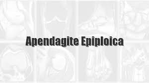 Apendagite epiplóica: Uma causa incomum de abdome agudo